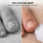 AX260607 Elektrische Nageltrimmer